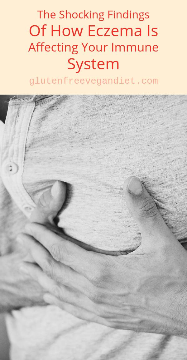 How Eczema is Affecting your Immune System