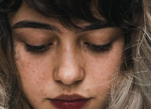 How To Have Smooth, Poreless, Acne-free Skin