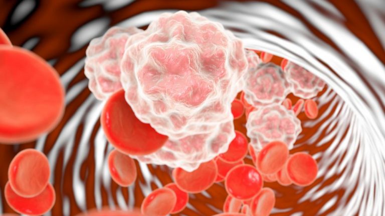The Role Of Inflammation In The Body